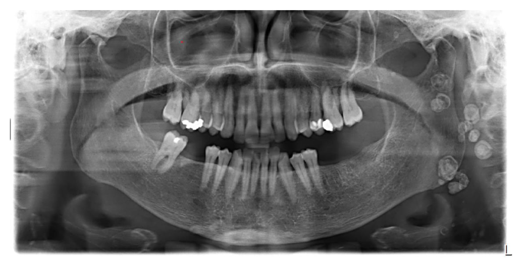 عکس رادیولوژی دندان اسلامشهر